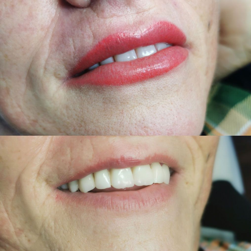Iria Piris micropigmentación de labios